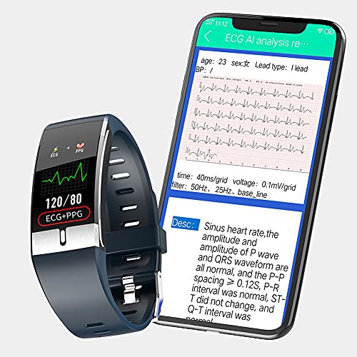Temperatura Corporea Smartwatch Uomo ECG Orologio Intelligente Donn...