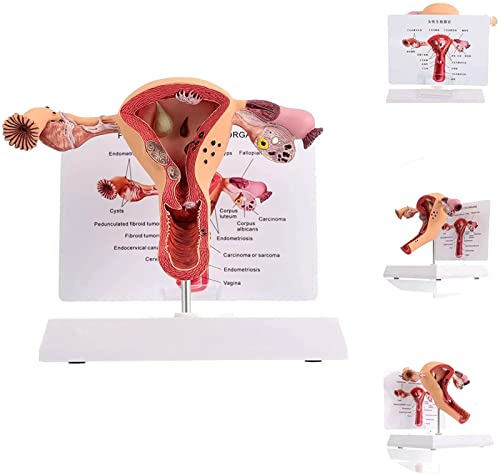 LENFUN Modello 3D Utero Umano E Ovaio - Replica Anatomica del Siste...